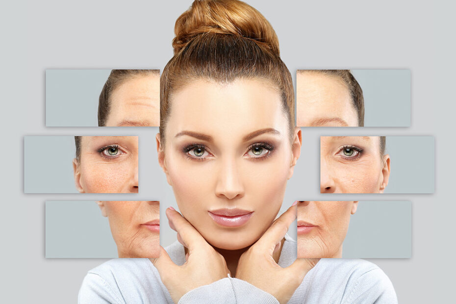 How Does Microneedling Address Fine Lines And Wrinkles