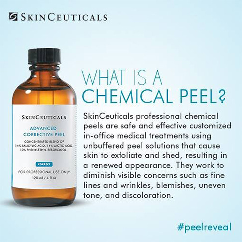 What is Chemical Peel