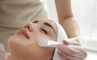 4 Frequently Asked Questions About Chemical Peels