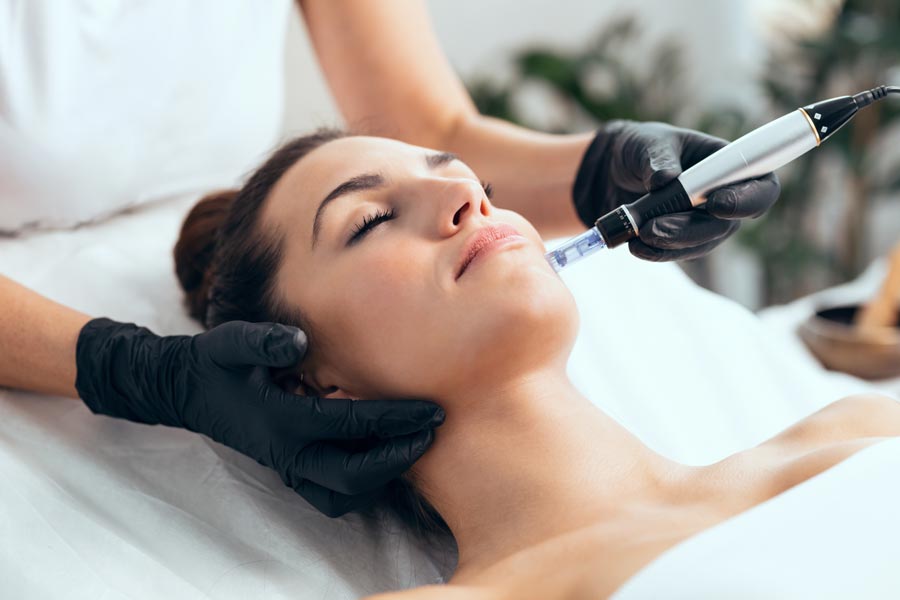 Microneedling treatments