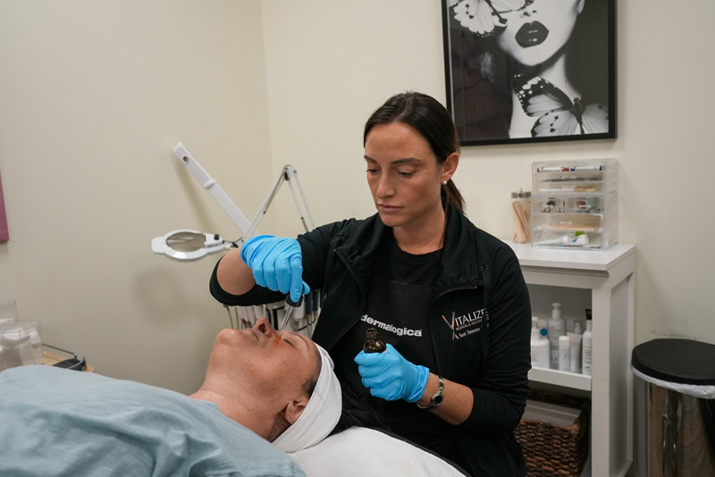 PRP Facials in Rochester, NY